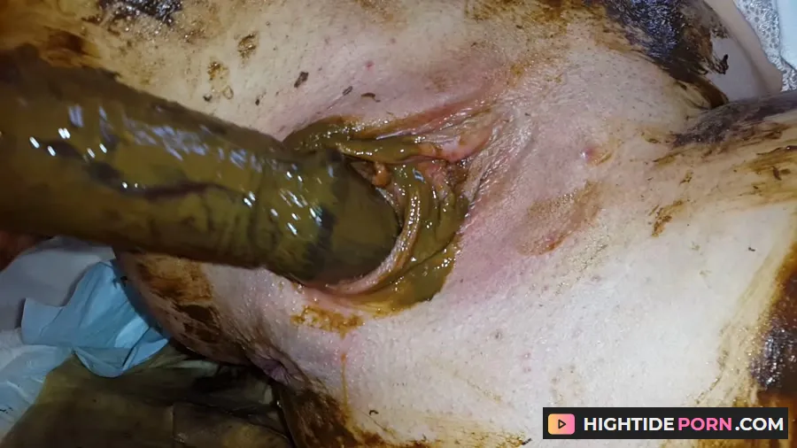 Anna Coprofield - Gynecological Self-Examination Shit - Filled Pussy Thought The Speculum - Scat [FullHD 1080p]