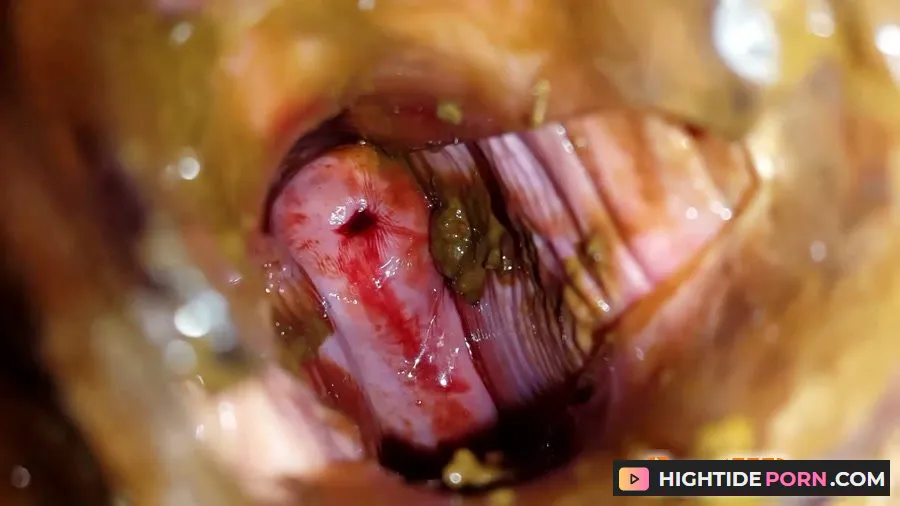 Anna Coprofield - Shit and Blood Vol.5 Speculum Full version - Scat [FullHD 1080p]