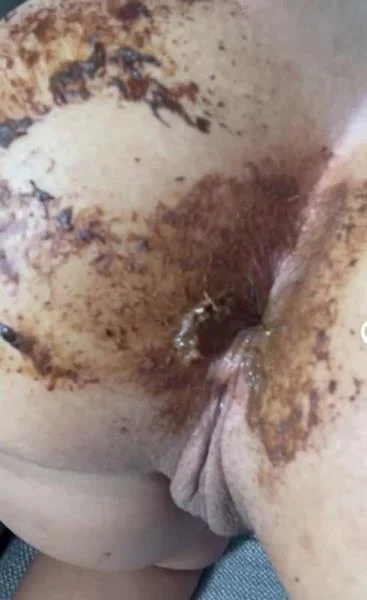 Aftermath of last video - Stuhlgang Porno [HD 720p] Scatbook