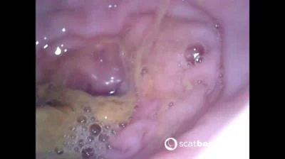 Show Inside Of My Ass With Endoscope (FullHD 1080p) Scatbook.com
